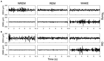 Analysis of circadian rhythm components in EEG/EMG data of aged mice